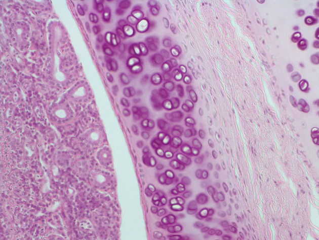 Trachea Slides - Trachea 03 40X